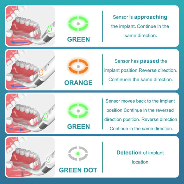 AI Dental Implant Locator Cross-Scanning Spot Screwdriver 360° Rotatable Sensor Localization Detector Tool AI-ID1 - Image 6